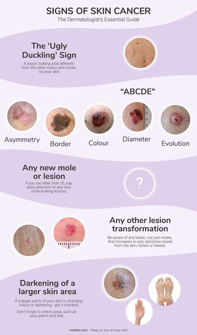 skin-cancer-photos-early-stages